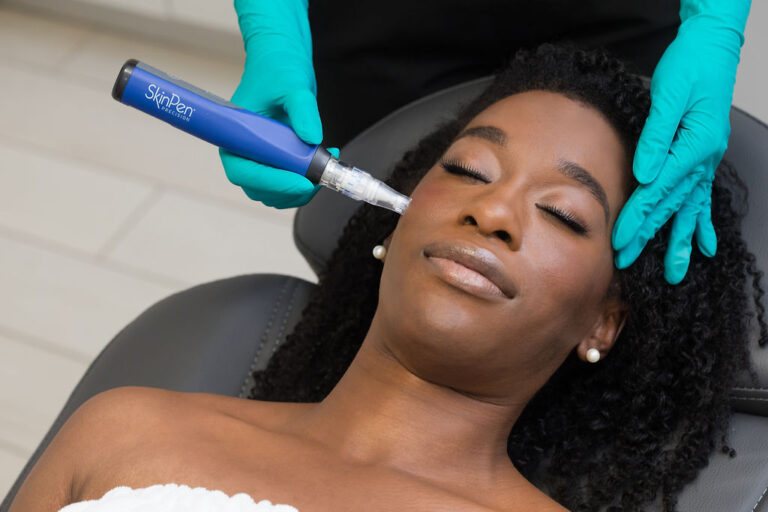 SkinPen microneedling tool held to cheek