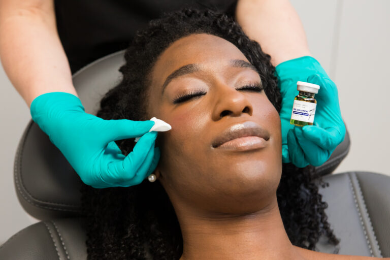 Chemical Peels FAQ: Your Questions Answered
